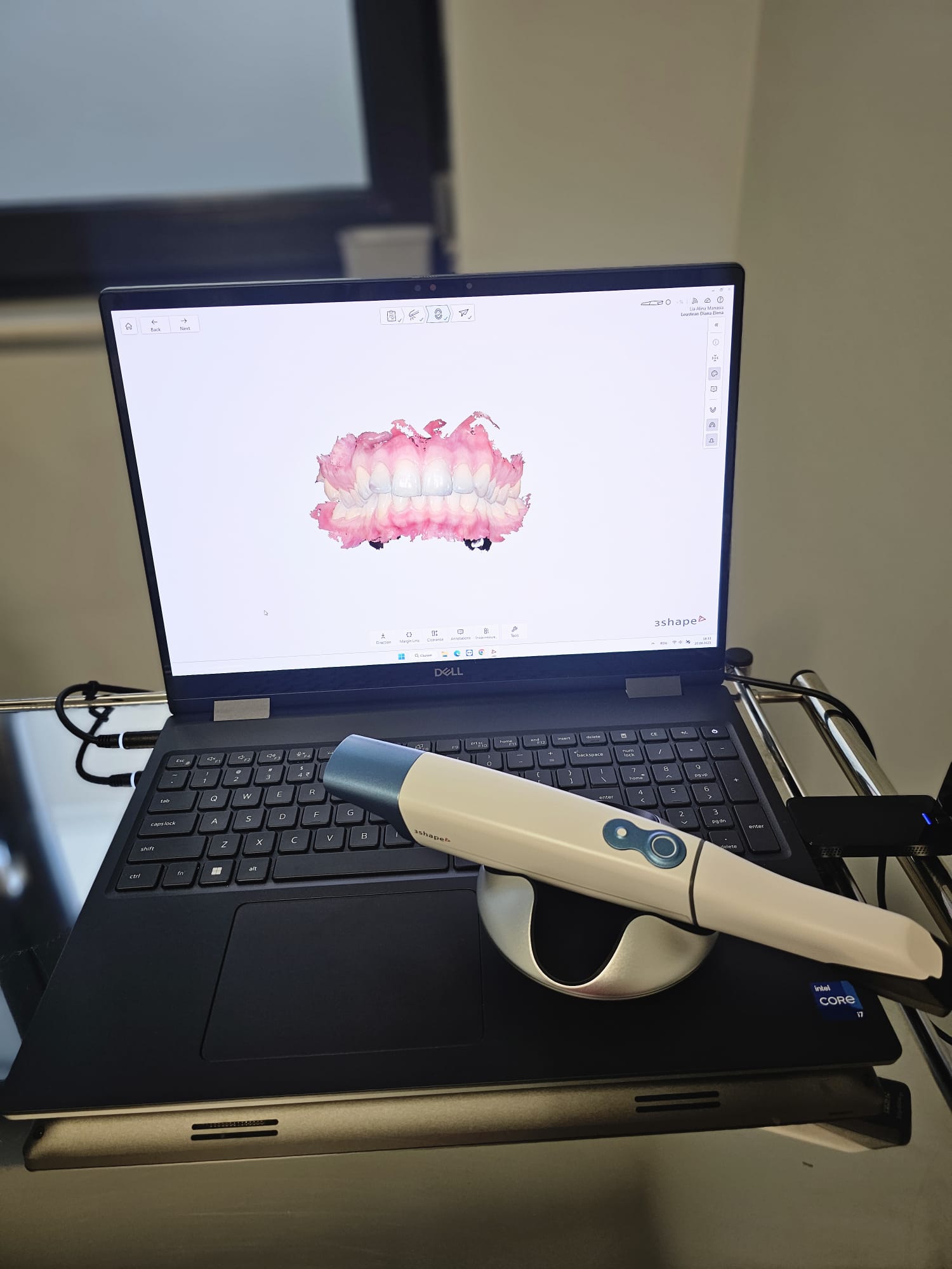 Amprentă digitală realizată cu TRIOS 6 scanner intraoral