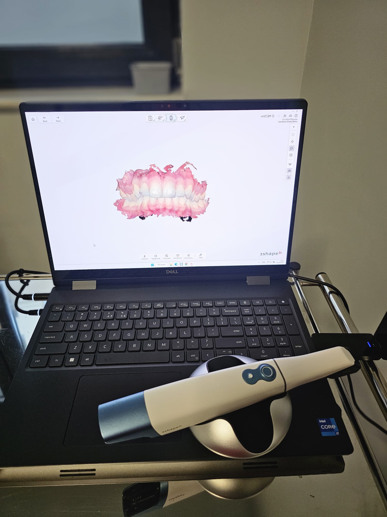 Pacient în timpul scanării digitale cu TRIOS 6 la Clinica Dr. Lia Manasia