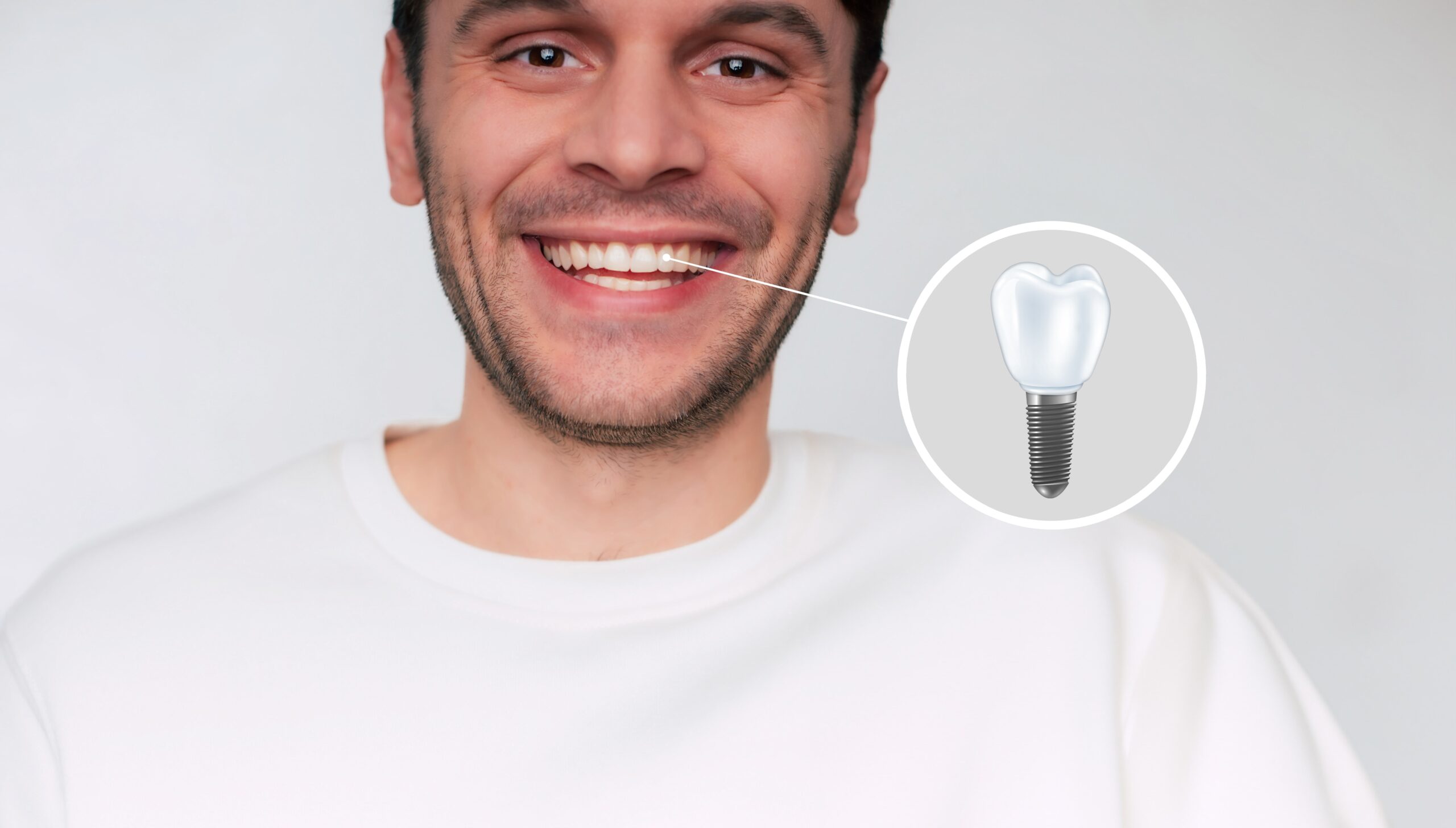 implant dentar Straumann pret si beneficii Bucuresti